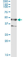 SEPT1 / Septin 1 Antibody - Immunoprecipitation of SEPT1 transfected lysate using anti-SEPT1 monoclonal antibody and Protein A Magnetic Bead, and immunoblotted with SEPT1 rabbit polyclonal antibody.