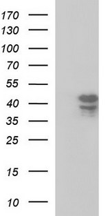 SEPT1 / Septin 1 Antibody - HEK293T cells were transfected with the pCMV6-ENTRY control (Left lane) or pCMV6-ENTRY SEPT1 (Right lane) cDNA for 48 hrs and lysed. Equivalent amounts of cell lysates (5 ug per lane) were separated by SDS-PAGE and immunoblotted with anti-SEPT1.