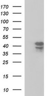 SEPT1 / Septin 1 Antibody - HEK293T cells were transfected with the pCMV6-ENTRY control (Left lane) or pCMV6-ENTRY SEPT1 (Right lane) cDNA for 48 hrs and lysed. Equivalent amounts of cell lysates (5 ug per lane) were separated by SDS-PAGE and immunoblotted with anti-SEPT1.