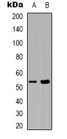 SEPT1 / Septin 1 Antibody - Western blot analysis of Septin 1 expression in COLO205 (A); Raw264.7 (B) whole cell lysates.