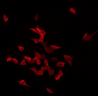 SEPT1 / Septin 1 Antibody - Staining HeLa cells by IF/ICC. The samples were fixed with PFA and permeabilized in 0.1% Triton X-100, then blocked in 10% serum for 45 min at 25°C. The primary antibody was diluted at 1:200 and incubated with the sample for 1 hour at 37°C. An Alexa Fluor 594 conjugated goat anti-rabbit IgG (H+L) Ab, diluted at 1/600, was used as the secondary antibody.