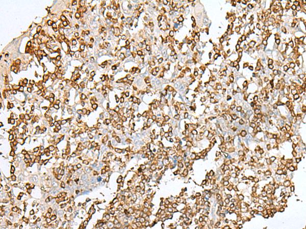 SEPT1 / Septin 1 Antibody - Immunohistochemistry of paraffin-embedded Human tonsil tissue  using SEPT1 Polyclonal Antibody at dilution of 1:50(×200)