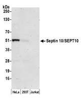SEPT10 /Septin 10 Antibody - Detection of human Septin 10/SEPT10 by western blot. Samples: Whole cell lysate (50 µg) from HeLa, HEK293T, and Jurkat cells prepared using NETN lysis buffer. Antibody: Affinity purified rabbit anti-Septin 10/SEPT10 antibody used for WB at 0.1 µg/ml. Detection: Chemiluminescence with an exposure time of 3 minutes.