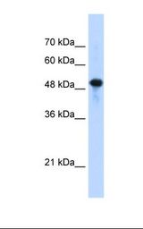 SEPT10 /Septin 10 Antibody - Jurkat cell lysate. Antibody concentration: 1.25 ug/ml. Gel concentration: 12%.  This image was taken for the unconjugated form of this product. Other forms have not been tested.