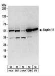 SEPT11 / Septin 11 Antibody - Detection of Human and Mouse Septin 11 by Western Blot. Samples: Whole cell lysate (50 ug) from HeLa, 293T, Jurkat, mouse TCMK-1, and mouse NIH3T3 cells. Antibodies: Affinity purified rabbit anti-Septin 11 antibody used for WB at 0.2 ug/ml. Detection: Chemiluminescence with an exposure time of 3 minutes.