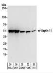 SEPT11 / Septin 11 Antibody - Detection of Human and Mouse Septin 11 by Western Blot. Samples: Whole cell lysate (50 ug) from HeLa, 293T, Jurkat, mouse TCMK-1, and mouse NIH3T3 cells. Antibodies: Affinity purified rabbit anti-Septin 11 antibody used for WB at 0.1 ug/ml. Detection: Chemiluminescence with an exposure time of 30 seconds.