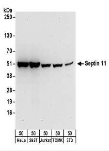 SEPT11 / Septin 11 Antibody - Detection of Human and Mouse Septin 11 by Western Blot. Samples: Whole cell lysate (50 ug) from HeLa, 293T, Jurkat, mouse TCMK-1, and mouse NIH3T3 cells. Antibodies: Affinity purified rabbit anti-Septin 11 antibody used for WB at 0.1 ug/ml. Detection: Chemiluminescence with an exposure time of 30 seconds.