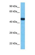 SEPT11 / Septin 11 Antibody - Western blot of SEPT11 Antibody with human Fetal Kidney lysate.  This image was taken for the unconjugated form of this product. Other forms have not been tested.