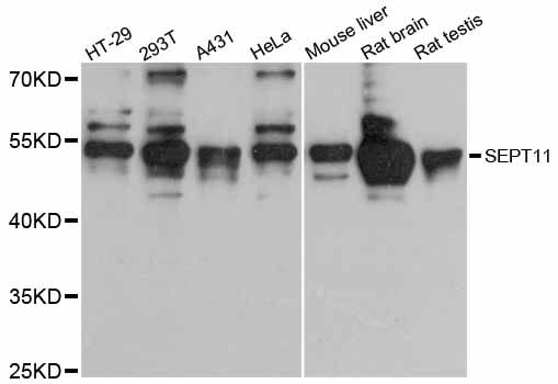 SEPT11 / Septin 11 Antibody - Western blot analysis of extracts of various cell lines, using SEPT11 antibody at 1:3000 dilution. The secondary antibody used was an HRP Goat Anti-Rabbit IgG (H+L) at 1:10000 dilution. Lysates were loaded 25ug per lane and 3% nonfat dry milk in TBST was used for blocking. An ECL Kit was used for detection and the exposure time was 10s.