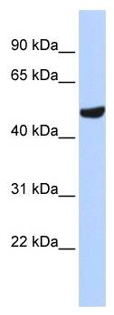 SEPT11 / Septin 11 Antibody - Western analysis of MCF7 cell lysate.  This image was taken for the unconjugated form of this product. Other forms have not been tested.