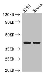 SEPT12 / Septin 12 Antibody - Western Blot Positive WB detected in: A375 whole cell lysate, Mouse brain tissue All lanes: SEPT12 antibody at 3.5µg/ml Secondary Goat polyclonal to rabbit IgG at 1/50000 dilution Predicted band size: 41, 36 kDa Observed band size: 41 kDa