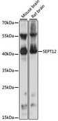 SEPT12 / Septin 12 Antibody - Western blot analysis of extracts of various cell lines, using SEPT12 antibody at 1:1000 dilution. The secondary antibody used was an HRP Goat Anti-Rabbit IgG (H+L) at 1:10000 dilution. Lysates were loaded 25ug per lane and 3% nonfat dry milk in TBST was used for blocking. An ECL Kit was used for detection and the exposure time was 1s.