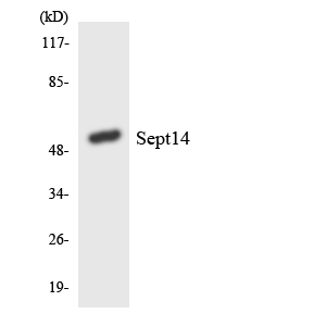 SEPT14 Antibody - Western blot analysis of the lysates from Jurkat cells using SEPT14 antibody.