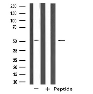 SEPT14 Antibody - Western blot analysis of extracts of NIH-3T3 cells using SEPT14 antibody.