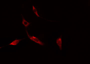 SEPT14 Antibody - Staining NIH-3T3 cells by IF/ICC. The samples were fixed with PFA and permeabilized in 0.1% Triton X-100, then blocked in 10% serum for 45 min at 25°C. The primary antibody was diluted at 1:200 and incubated with the sample for 1 hour at 37°C. An Alexa Fluor 594 conjugated goat anti-rabbit IgG (H+L) antibody, diluted at 1/600, was used as secondary antibody.
