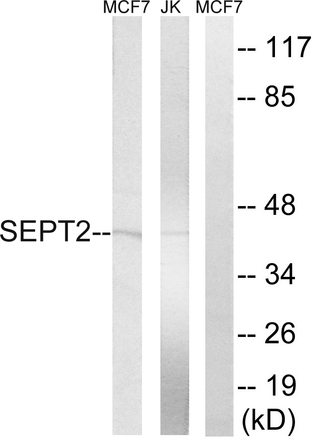 SEPT2 / Septin 2 Antibody - Western blot analysis of lysates from Jurkat and MCF-7 cells, using SEPT2 Antibody. The lane on the right is blocked with the synthesized peptide.