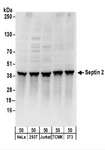 SEPT2 / Septin 2 Antibody - Detection of Human and Mouse Septin 2 by Western Blot. Samples: Whole cell lysate (50 ug) from HeLa, 293T, Jurkat, mouse TCMK-1, and mouse NIH3T3 cells. Antibodies: Affinity purified rabbit anti-Septin 2 antibody used for WB at 0.1 ug/ml. Detection: Chemiluminescence with an exposure time of 30 seconds.