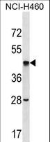 SEPT2 / Septin 2 Antibody - SEPT2 Antibody western blot of NCI-H460 cell line lysates (35 ug/lane). The SEPT2 antibody detected the SEPT2 protein (arrow).