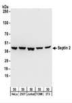 SEPT2 / Septin 2 Antibody - Detection of Human and Mouse Septin 2 by Western Blot. Samples: Whole cell lysate (50 ug) from HeLa, 293T, Jurkat, mouse TCMK-1, and mouse NIH3T3 cells. Antibodies: Affinity purified rabbit anti-Septin 2 antibody used for WB at 0.1 ug/ml. Detection: Chemiluminescence with an exposure time of 30 seconds.