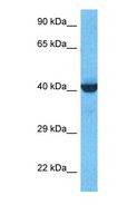 SEPT2 / Septin 2 Antibody - Western blot of SEPT2 Antibody with human MCF7 Whole Cell lysate.  This image was taken for the unconjugated form of this product. Other forms have not been tested.