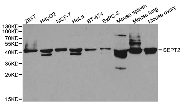 SEPT2 / Septin 2 Antibody - Western blot analysis of extracts of various cell lines.
