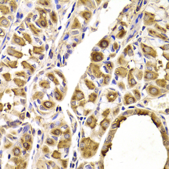 SEPT2 / Septin 2 Antibody - Immunohistochemistry of paraffin-embedded Human gastric tissue.