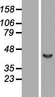 SEPT2 / Septin 2 Protein - Western validation with an anti-DDK antibody * L: Control HEK293 lysate R: Over-expression lysate