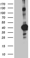 SEPT3 / Septin 3 Antibody - HEK293T cells were transfected with the pCMV6-ENTRY control. (Left lane) or pCMV6-ENTRY SEPT3. (Right lane) cDNA for 48 hrs and lysed. Equivalent amounts of cell lysates. (5 ug per lane) were separated by SDS-PAGE and immunoblotted with anti-SEPT3. (1:2000)