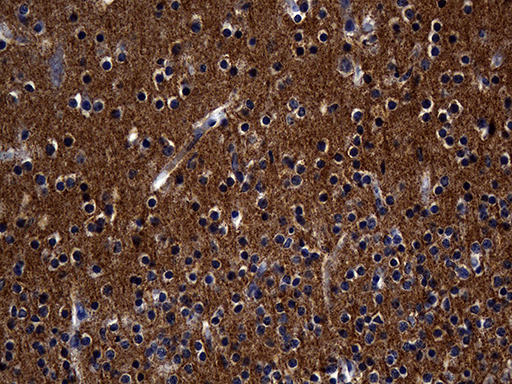 SEPT3 / Septin 3 Antibody - Immunohistochemical staining of paraffin-embedded Human adult brain tissue within the normal limits using anti-SEPT3 mouse monoclonal antibody. (Heat-induced epitope retrieval by 1mM EDTA in 10mM Tris buffer. (pH8.5) at 120 oC for 3 min. (1:500)