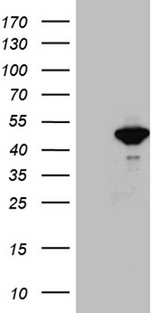 SEPT3 / Septin 3 Antibody - HEK293T cells were transfected with the pCMV6-ENTRY control. (Left lane) or pCMV6-ENTRY SEPT3. (Right lane) cDNA for 48 hrs and lysed. Equivalent amounts of cell lysates. (5 ug per lane) were separated by SDS-PAGE and immunoblotted with anti-SEPT3. (1:2000)