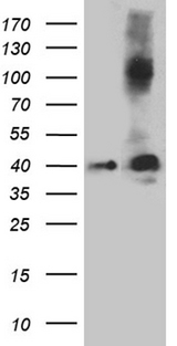 SEPT3 / Septin 3 Antibody - HEK293T cells were transfected with the pCMV6-ENTRY control. (Left lane) or pCMV6-ENTRY SEPT3. (Right lane) cDNA for 48 hrs and lysed