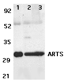 SEPT4 / Septin 4 Antibody - Western blot analysis of ARTS expression in human lung (lane 1),spleen (lane 2), and kidney (lane 3) tissue lysates with ARTS antibody at 2µg /ml.;