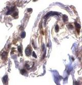 SEPT4 / Septin 4 Antibody - Immunohistochemical staining of ARTS in human lung tissue with ARTS antibody at 2µg/ml.;