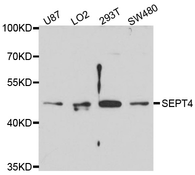 SEPT4 / Septin 4 Antibody - Western blot analysis of extracts of various cell lines, using SEPT4 antibody at 1:1000 dilution. The secondary antibody used was an HRP Goat Anti-Rabbit IgG (H+L) at 1:10000 dilution. Lysates were loaded 25ug per lane and 3% nonfat dry milk in TBST was used for blocking. An ECL Kit was used for detection and the exposure time was 90s.