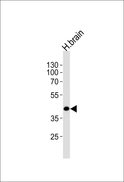 SEPT5 / Septin 5 Antibody - Western blot of lysate from human brain tissue lysate, using SEPT5 Antibody. Antibody was diluted at 1:1000 at each lane. A goat anti-rabbit IgG H&L (HRP) at 1:5000 dilution was used as the secondary antibody. Lysate at 35ug per lane.