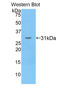 SEPT5 / Septin 5 Antibody - Western blot of recombinant SEPT5 / Septin 5.  This image was taken for the unconjugated form of this product. Other forms have not been tested.