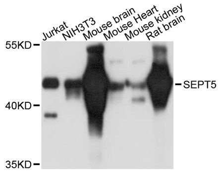 SEPT5 / Septin 5 Antibody - Western blot analysis of extracts of various cell lines, using SEPT5 antibody at 1:3000 dilution. The secondary antibody used was an HRP Goat Anti-Rabbit IgG (H+L) at 1:10000 dilution. Lysates were loaded 25ug per lane and 3% nonfat dry milk in TBST was used for blocking. An ECL Kit was used for detection and the exposure time was 30s.