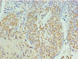 SEPT6 / Septin 6 Antibody - Immunohistochemistry of paraffin-embedded human tonsil using antibody at 1:100 dilution.