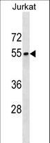 SEPT6 / Septin 6 Antibody - SEPT6 Antibody western blot of Jurkat cell line lysates (35 ug/lane). The SEPT6 antibody detected the SEPT6 protein (arrow).