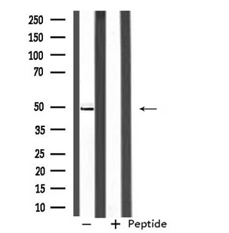 SEPT6 / Septin 6 Antibody - Western blot analysis of extracts of Jurkat cells using SEPT6 antibody.