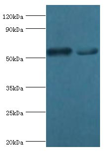 SEPT7 / Septin 7 Antibody - Western blot. All lanes: Septin-7 antibody at 9 ug/ml. Lane 1: HeLa whole cell lysate. Lane 2: mouse gonad tissue. Secondary antibody: Goat polyclonal to rabbit at 1:10000 dilution. Predicted band size: 51 kDa. Observed band size: 51 kDa.
