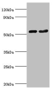 SEPT7 / Septin 7 Antibody - Western blot All lanes: Septin-7 antibody at 9µg/ml Lane 1: Hela whole cell lysate Lane 2: Mouse gonad tissue Secondary Goat polyclonal to rabbit IgG at 1/10000 dilution Predicted band size: 51 kDa Observed band size: 51 kDa