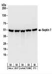 SEPT7 / Septin 7 Antibody - Detection of Human and Mouse Septin 7 by Western Blot. Samples: Whole cell lysate (50 ug) from HeLa, 293T, Jurkat, mouse TCMK-1, and mouse NIH3T3 cells. Antibodies: Affinity purified rabbit anti-Septin 7 antibody used for WB at 0.1 ug/ml. Detection: Chemiluminescence with an exposure time of 1 second.