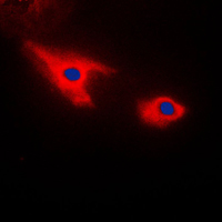 SEPT7 / Septin 7 Antibody - Immunofluorescent analysis of Septin 7 staining in HepG2 cells. Formalin-fixed cells were permeabilized with 0.1% Triton X-100 in TBS for 5-10 minutes and blocked with 3% BSA-PBS for 30 minutes at room temperature. Cells were probed with the primary antibody in 3% BSA-PBS and incubated overnight at 4 C in a humidified chamber. Cells were washed with PBST and incubated with a DyLight 594-conjugated secondary antibody (red) in PBS at room temperature in the dark. DAPI was used to stain the cell nuclei (blue).