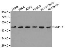 SEPT7 / Septin 7 Antibody - Western blot analysis of extracts of various cell lines, using SEPT7 antibody.