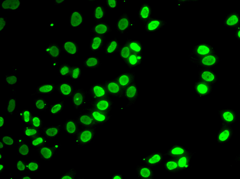 SEPT7 / Septin 7 Antibody - Immunofluorescence analysis of HeLa cells.