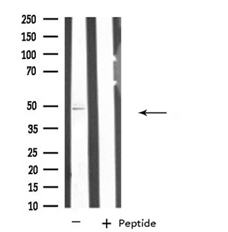 SEPT7 / Septin 7 Antibody - Western blot analysis of extracts of MCF-7 cells using SEPT7 antibody.
