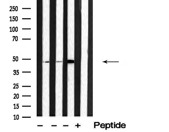 SEPT7 / Septin 7 Antibody - Western blot analysis of SEPT7 expression in various lysates