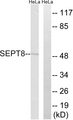 SEPT8 / Septin 8 Antibody - Western blot analysis of lysates from HeLa cells, using SEPT8 Antibody. The lane on the right is blocked with the synthesized peptide.