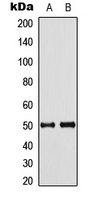 SEPT8 / Septin 8 Antibody - Western blot analysis of Septin 8 expression in HeLa (A); mouse brain (B) whole cell lysates.